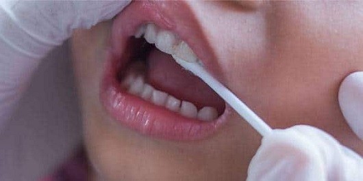 اجرای رایگان طرح وارنیش فلوراید در پیش دبستانی‌های استان یزد
